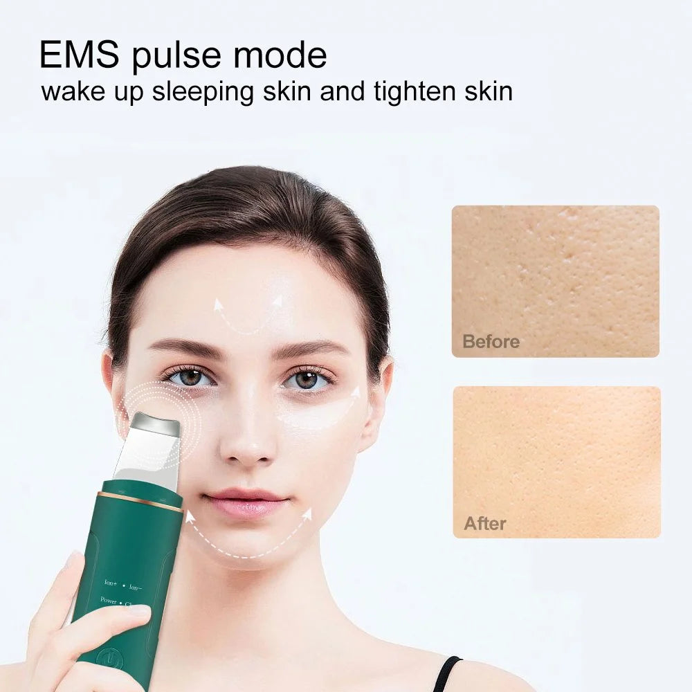 Skin Pore Cleaner Scrubber, Blackhead Acne Remover Pore Cleaner, Face Spatula with 4 Modes