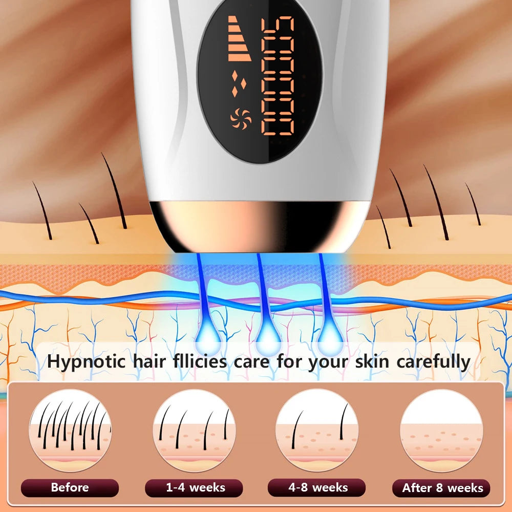 Permanent Laser Epilator 999999 Flashes Professional Painless Laser Hair Removal Machine for Women Body Facial Legs Bikini Line