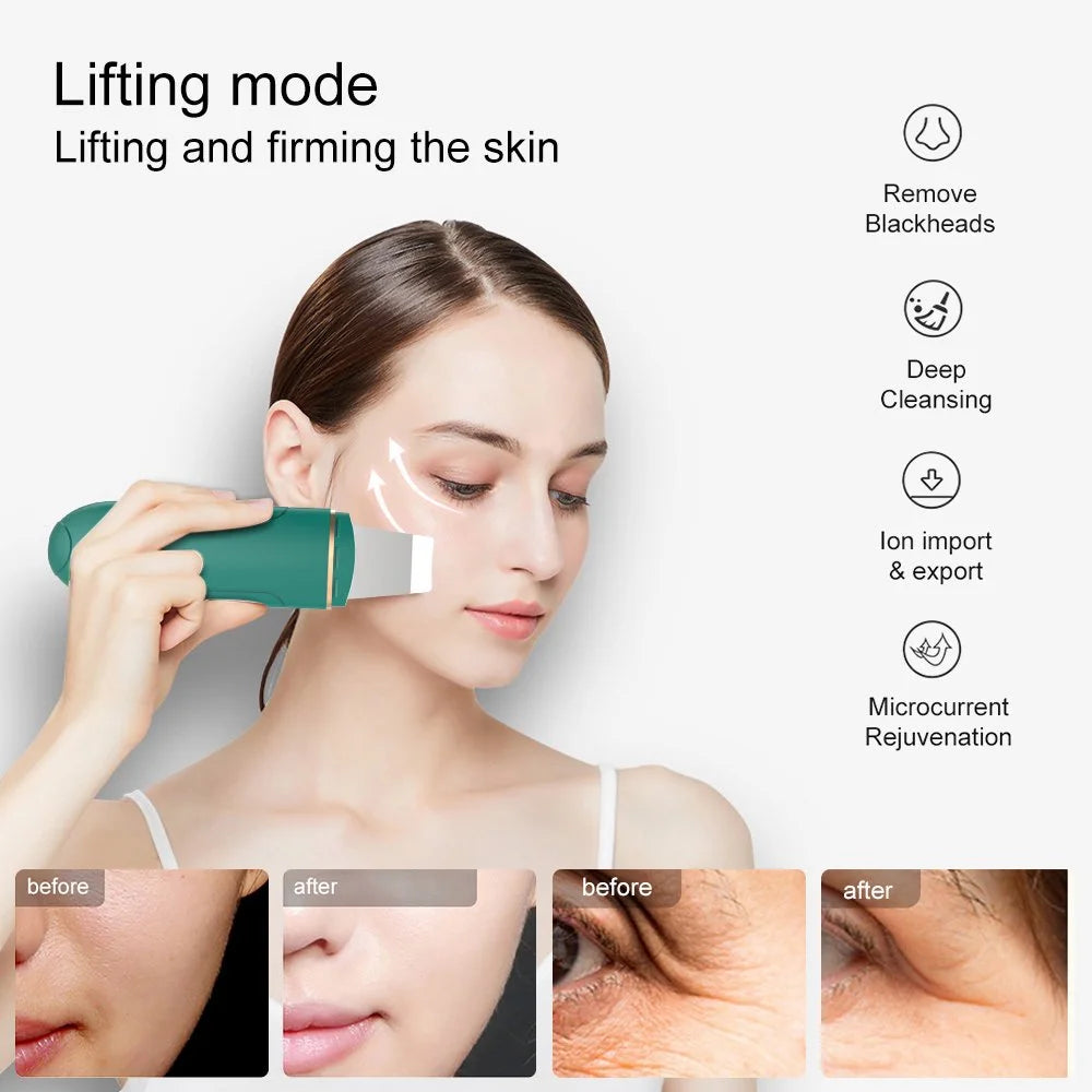 Skin Pore Cleaner Scrubber, Blackhead Acne Remover Pore Cleaner, Face Spatula with 4 Modes